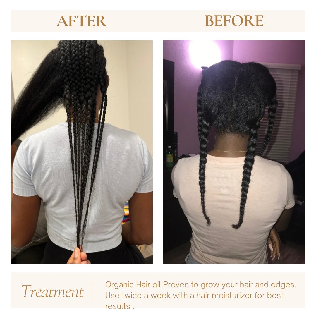 HAIR GROWTH OIL