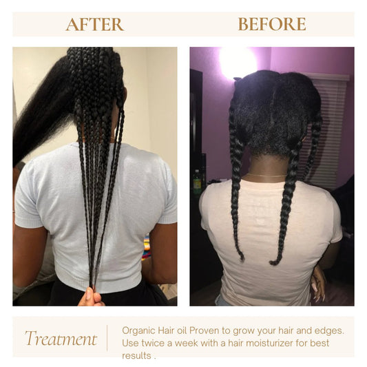 HAIR GROWTH OIL